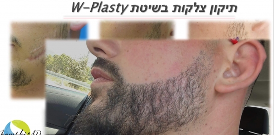 תיקון צלקות 11