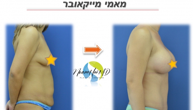 מאמי מייקאובר צד שמאל